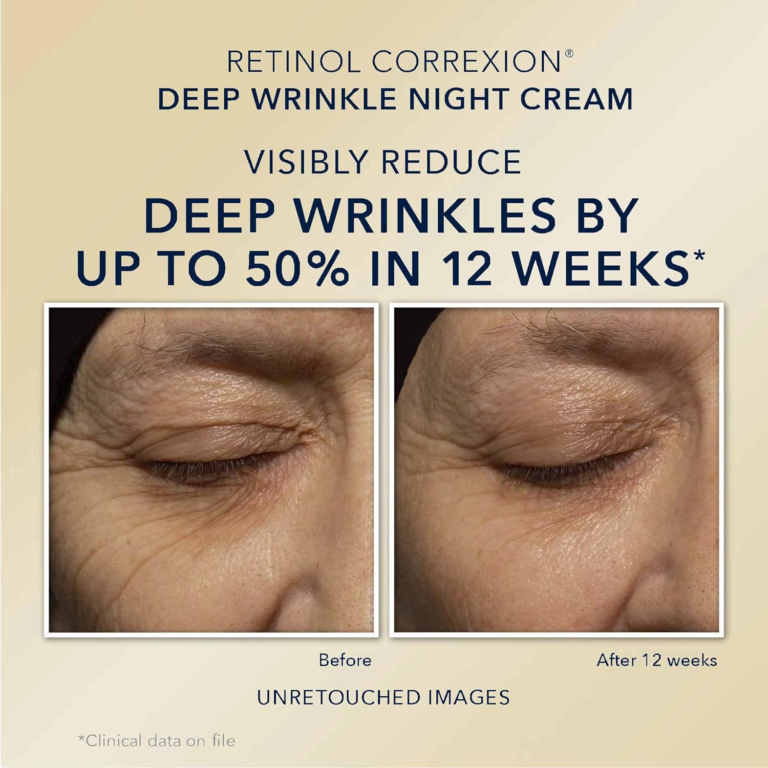 Retinol Anti-Aging Night Face Cream + Under Eye Cream Duo R252
